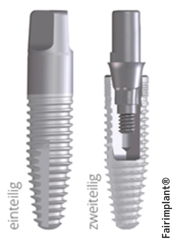 Einteilige und zweiteilige Implantate